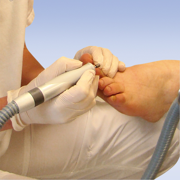 Nagelbehandlung - Podologie Bantleon