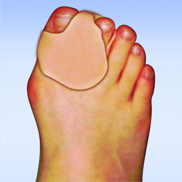 Orthosen - Podologie Bantleon